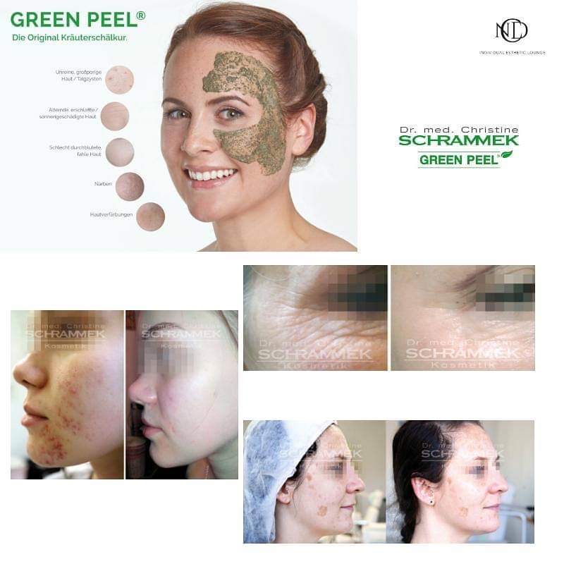 Dr.med. Christine SCHRAMMEK GREEN PEEL